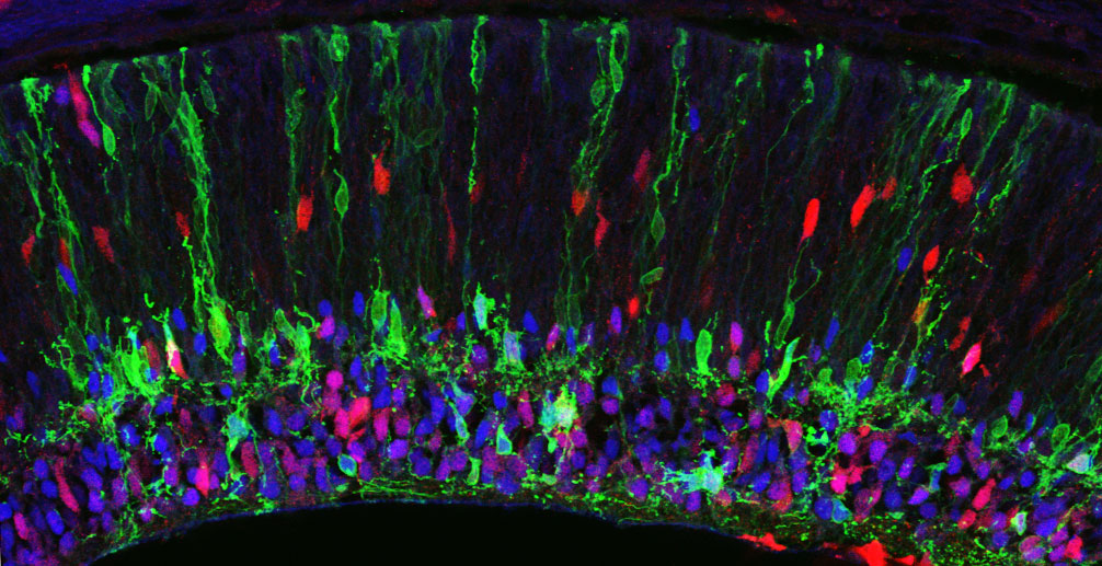 Image of cells organized spatially in the retina